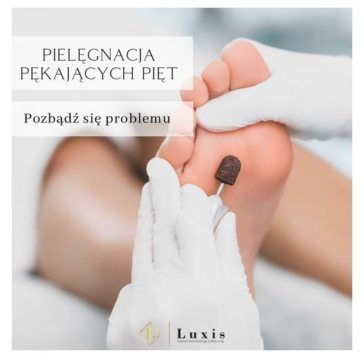 Zdjęcie na okładce dla Luxis Gabinet Podologii Pedicure Leczniczy Gdynia Usuwanie Odcisków Brodawek Modzeli Wrastający Paznokieć Pedicure Gdynia